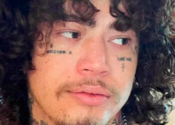 Whinderserson Nunes revela desconforto no palco pela primeira vez por conta da depressГѓВЈo
