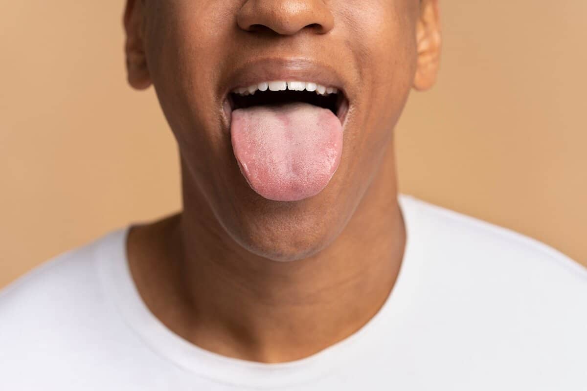 Your Tongue May Reveal Secrets About Your Health! Find Out How