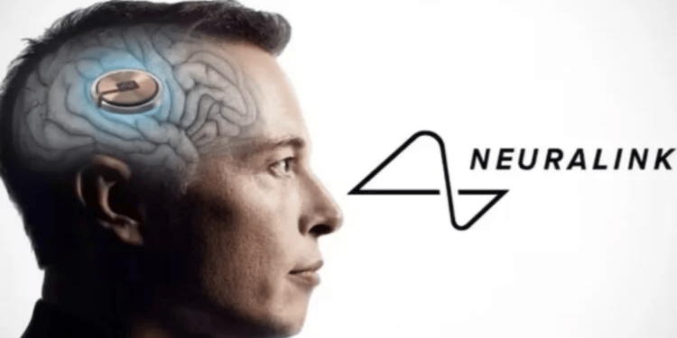 Neuralink De Elon Musk Implanta com Sucesso Segundo Chip Cerebral Em Paciente!