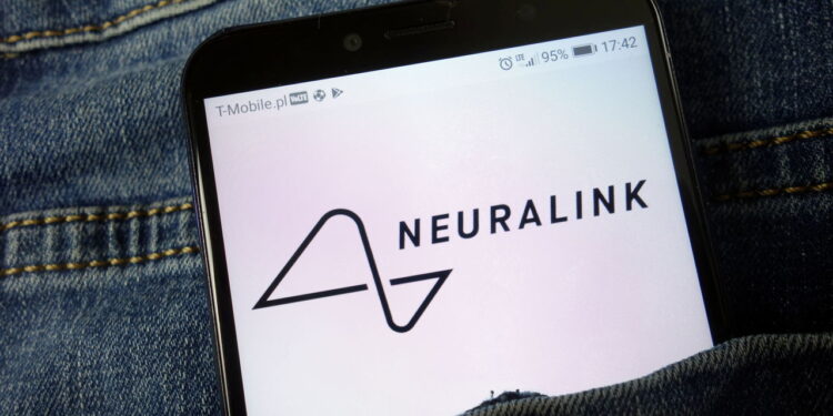 A tecnologia Neuralink em ação permite digitar por pensamento! Veja o avanço