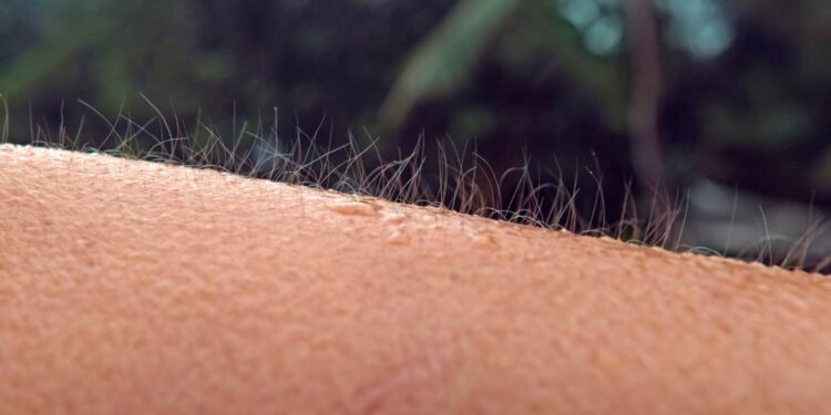 Pessoa caucasiana desconhecida fica arrepiada durante uma tempestade tropical fria. Close-up dos pelos do braço esvoaçando ao vento enquanto a garota irreconhecível não consegue escapar da chuva fria - Créditos: depositphotos.com / Prostock