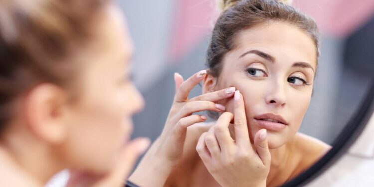 Por que sentimos prazer em espremer espinhas, segundo a psicologia