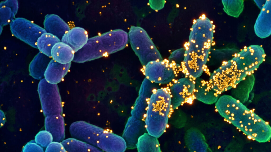 Além da mineração tradicional, esta bactéria microscópica excreta partículas de ouro puro, sendo uma descoberta revolucionária da microbiologia